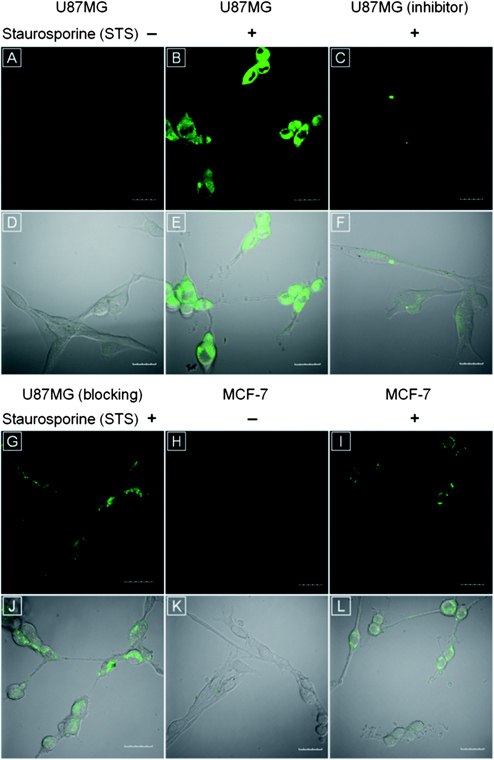 CLSM images of (A) healthy and (B) apoptotic U87MG cells upon treatment 