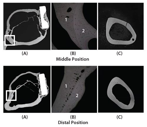 CMR (Contact Micro-Radiograph) images showing cross sections of fracture models implanted with and without bone plates made of TNTZ at middle position (above) and distal position (below) at 48 weeks after implantation. (A) Cross section of fracture model, (B) magnification of boxed area in (C) showing branched parts of bones that form the outer and inner sides of tibiae, and (C) cross sections of unimplanted tibiae. cross sections of fracture models implanted with and without bone plates made of TNTZ