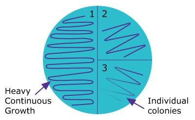 Petri dish divided into quadrants, showing varying growth patterns from heavy continuous growth to individual colonies. Petri dish divided into quadrants, showing varying growth patterns from heavy continuous growth to individual colonies.