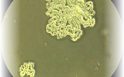 10x Magnification Mycobacterium Tuberculosis 10x Magnification Mycobacterium Tuberculosis