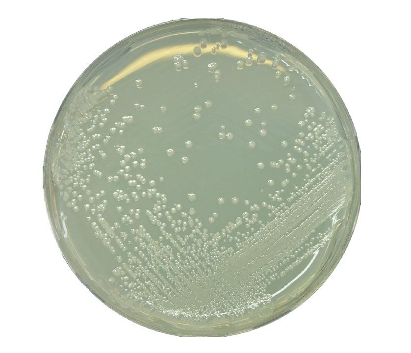 <i>Alicyclobacillus</i> spp. on BAT Agar