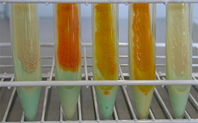 Different Mycobacteria Species Grown On TB-Medium Different mycobacteria species grown on TB-Medium