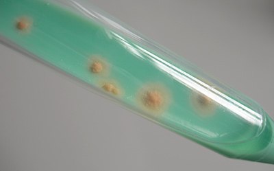 Mycobacteria Colonies On TB-Medium Mycobacteria colonies on TB-Medium
