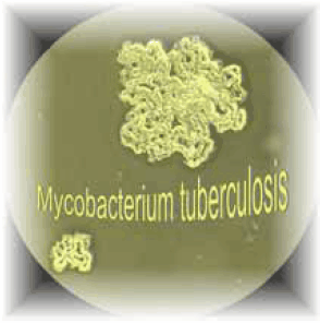 Typical colony of Mycobacterium tuberculosis seen under a microscope with 10x magnification