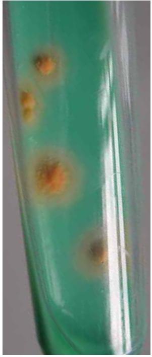 Mycobacteria colonies on TB-Medium Base according to Löwenstein-Jensen