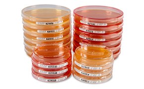 A close-up view of multiple petri dishes in various sizes, some stacked and others placed separately, all labeled, demonstrating a variety of cultured media in a laboratory setting. A close-up view of multiple petri dishes in various sizes, some stacked and others placed separately, all labeled, demonstrating a variety of cultured media in a laboratory setting.