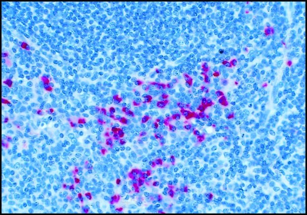 Formalin-fixed, paraffin-embedded section of human tonsil stained with Anti-Human IgG (gamma -chain specific)-Alkaline Phosphatase Conjugate, F(ab)2 fragment of goat antibody (Cat. No. A3312) using SIGMA FAST™ Fast Red TR/Naphthol AS-MX Tablets (Cat. No. F4523) as substrate.