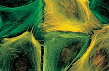 Double labeling of Mouse aorta cells with FITC-Phalloidin and Monoclonal Anti-α-Smooth Muscle Actin, Clone No. 1A4 (Product No. <a href="/product/sigma/A2547">A2547</a>). From E. Ehler and Dr. A. Draeger, Institute of Molecular Biology, Academy of Sciences, Salzburg. Double labeling of Mouse aorta cells with FITC-Phalloidin and Monoclonal Anti-α-Smooth Muscle Actin