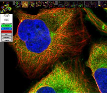 Anti-CCNB1 (cyclin B1) IF image with antibody staining, nucleaus staining and microtubule staining.