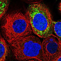 Anti-MRPS7 antibody stained in green showing single cell variation in A-431 cell line.