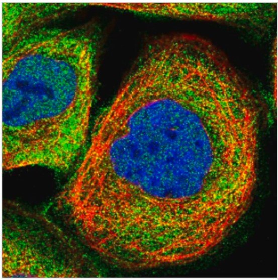 GPCR Markers for Cancer Research
