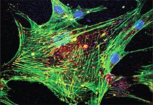 Immunofluorescence. Primary human osteoblast cells labeled with Anti- Vinculin (Cat. No. V9131) (red), actin was stained with Phalloidin (Cat. No. P5282) (green) and nuclei stained blue. From Eng San Thian, Materials Science and Metallurgy, University of Cambridge, Cambridge, United Kingdom. Immunofluorescence. Primary human osteoblast cells labeled with Anti- Vinculin