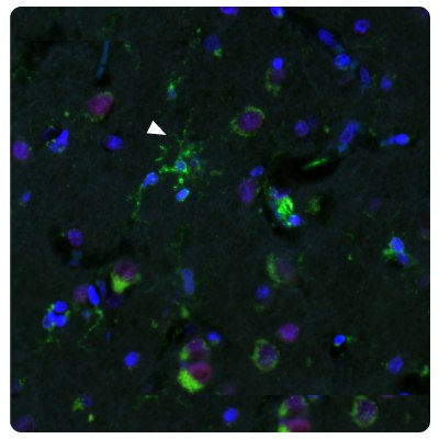 Image of IHC-IF staining of human normal cortex samples using Anti-HLA-DRA monoclonal and Anti-METTL21B polyclonal (Product No. HPA043020) antibodies showing HLA-DRA positive activated microglia.