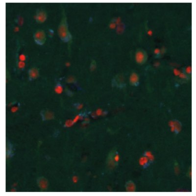 Multiplexed IHC-IF staining of human normal cortex samples using Anti-EZH2 monoclonal (Product No. AMAb91752), Anti-PARP1 monoclonal (Product No. AMAb90959), and Anti- ALDH1A3 monoclonal (Product No. AMAb91754) antibodies.