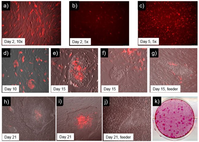 Time course of human iPSC colonies