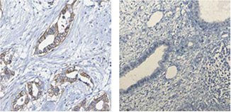 anti-gcm1-antibody