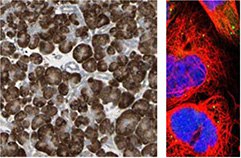 ihc-staining-of-human-pancreas-tissue