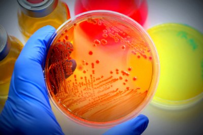 A gloved hand holding a petri dish containing orange agar with visible bacterial growth, surrounded by colorful culture bottles in the background A gloved hand holding a petri dish containing orange agar with visible bacterial growth, surrounded by colorful culture bottles in the background