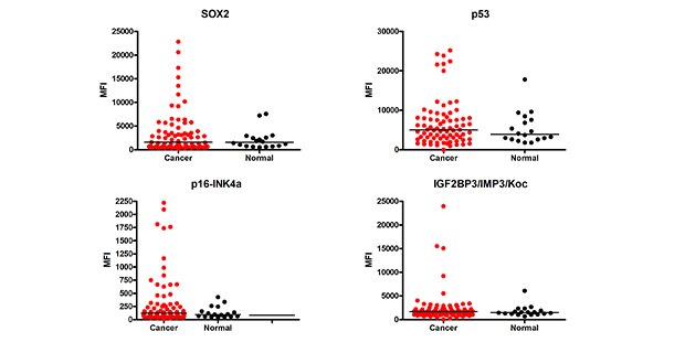 Cancer Autoantibody Analysis Graph showing data for cancer autoantibody analysis. Using MILLIPLEX® Human Cancer Autoantibody Panel Cat. No. HCABMAG-13K, the MFI (Median Fluorescence Intensity) values of the cancer autoantibody biomarkers were determined in cancer (breast, colorectal, ovarian, lung, prostate) (n=78) and healthy control (n=18) serum samples (samples diluted at 1:100).