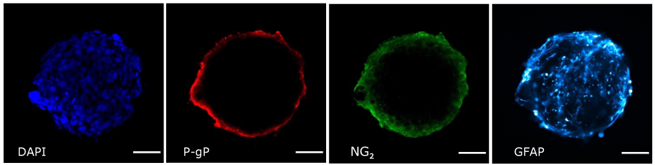 BBB organoid layers Immunofluorescence imaging of BBB organoid layers.