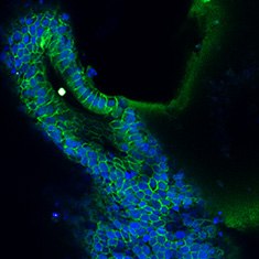 Mucin-5B/DAPI