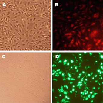 Human Coronary Artery Endothelial Cells (HCAEC) Human Coronary Artery Endothelial Cells (HCAEC)