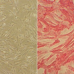 Human Pulmonary Artery Smooth Muscle Cells (HPASMC) Culture Protocol Human Pulmonary Artery Smooth Muscle Cells (HPASMC)