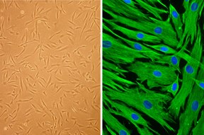 Human Follicle Dermal Papilla Cells (HFDPC) Human Follicle Dermal Papilla Cells (HFDPC)