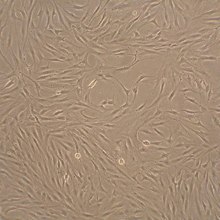 Human Fibroblast-Like Synoviocytes (HFLS) Human Fibroblast-Like Synoviocytes (HFLS)