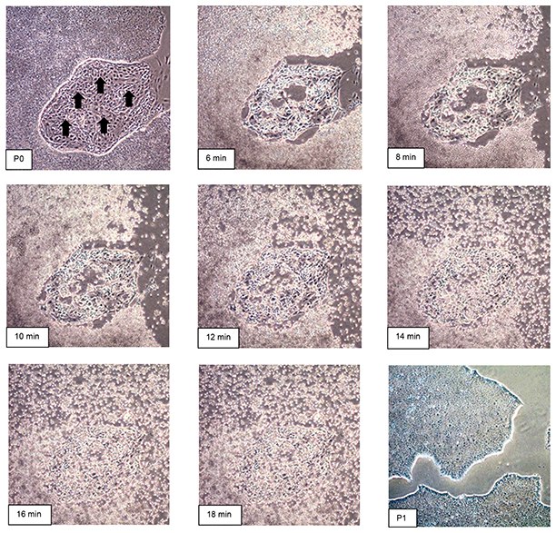 Time course of human iPS cell passaging using EZ-LiFT™ reagent.