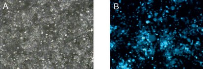 Transfection efficiency