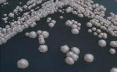 Several baker’s yeast colonies on a microbiological medium Several baker’s yeast colonies on a microbiological medium