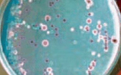 Candida Ident Agar, modified (Candida albicans = green-coloured smooth colonies, Candida tropicalis = blue to metallic blue-coloured raised colonies. Candida glabrata = cream to white, Candida krusei = purple coloured fuzzy colonies) Candida Ident Agar, modified
