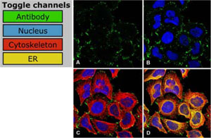 Anti-ZYX shows staining of focal adhesions