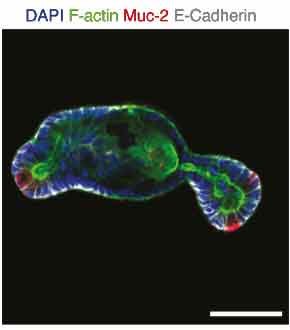 Protein expression of mucin-2 Protein expression of mucin-2