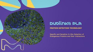 Duolink<sup>®</sup> Proximity Ligation Assay