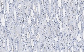 Anti-Atg5 Antibody, clone 1L18 ZooMAb&#174; Rabbit Monoclonal recombinant, expressed in HEK 293 cells