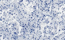 Anti-PI3 Kinase p110 β Antibody, clone 1D18 ZooMAb&#174; Rabbit Monoclonal recombinant, expressed in HEK 293 cells