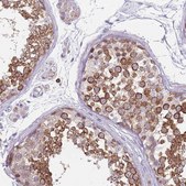Anti-DDX4 antibody produced in rabbit Prestige Antibodies&#174; Powered by Atlas Antibodies, affinity isolated antibody, buffered aqueous glycerol solution