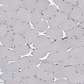 Anti-CCR4 antibody produced in rabbit Prestige Antibodies&#174; Powered by Atlas Antibodies, affinity isolated antibody, buffered aqueous glycerol solution