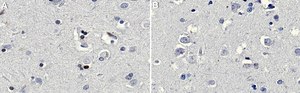 Anti-Olig2 Antibody, clone 211F1.1 clone 211F1.1, from mouse