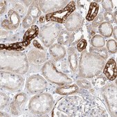 Anti-MTFR1L antibody produced in rabbit Prestige Antibodies&#174; Powered by Atlas Antibodies, affinity isolated antibody, buffered aqueous glycerol solution, ab2