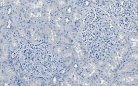 Anti-Rab7A Antibody, clone 4E15 ZooMAb&#174; Rabbit Monoclonal recombinant, expressed in HEK 293 cells