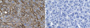 Anti-SLC13A5 Antibody, clone 1D4 ZooMAb&#174; Rabbit Monoclonal recombinant, expressed in HEK 293 cells