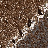 Anti-SPTAN1 antibody produced in rabbit Prestige Antibodies&#174; Powered by Atlas Antibodies, affinity isolated antibody, buffered aqueous glycerol solution