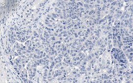 Anti-MDM2 Antibody, clone IF2 ZooMAb&#174; Mouse Monoclonal recombinant, expressed in HEK 293 cells