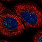 Anti-CRAT antibody produced in rabbit Prestige Antibodies&#174; Powered by Atlas Antibodies, affinity isolated antibody, buffered aqueous glycerol solution, Ab3