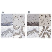 Anti-G3BP2 antibody produced in rabbit Prestige Antibodies&#174; Powered by Atlas Antibodies, affinity isolated antibody, buffered aqueous glycerol solution