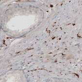 Monoclonal Anti-UCHL1 antibody produced in mouse Prestige Antibodies&#174; Powered by Atlas Antibodies, clone CL3210, purified immunoglobulin, buffered aqueous glycerol solution