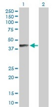 Anti-B4GALNT1 antibody produced in rabbit purified immunoglobulin, buffered aqueous solution